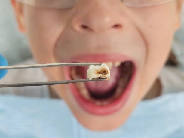 Best Orthodontic Emergency Dentist in Deridder, LA