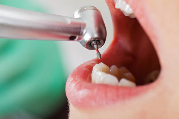 Best Emergency Cosmetic Dentistry in Deridder, LA